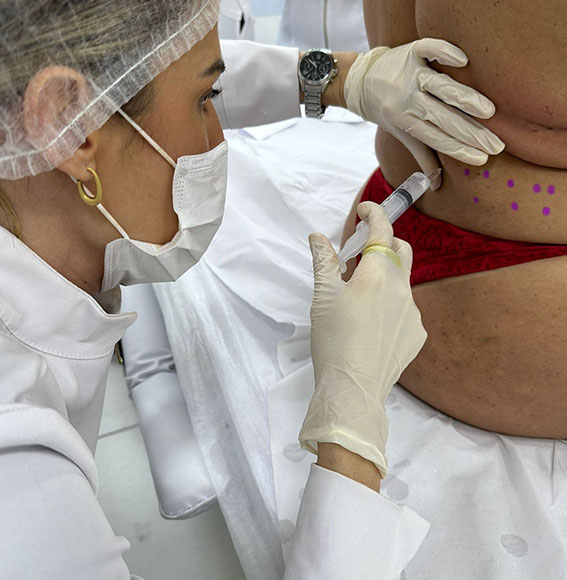 INTRADERMOTERAPIA